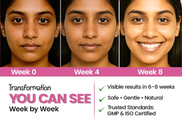 Girlyveda Pigmo Fight Anti Pigmentation Tablets for Dark Spots