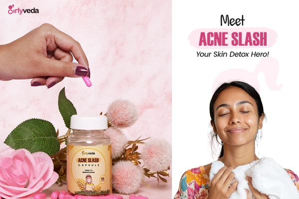 Acne Capsule: Ayurvedic Acne Relief Capsules for Women