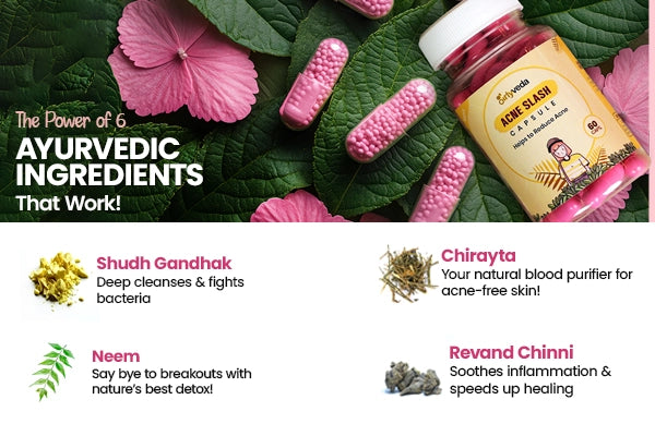 Acne Capsule: Ayurvedic Acne Relief Capsules for Women