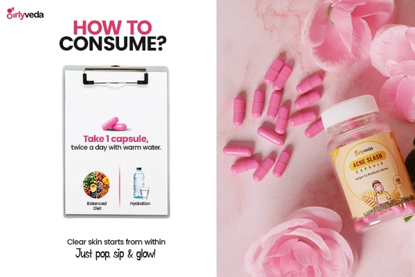 Acne Capsule: Ayurvedic Acne Relief Capsules for Women