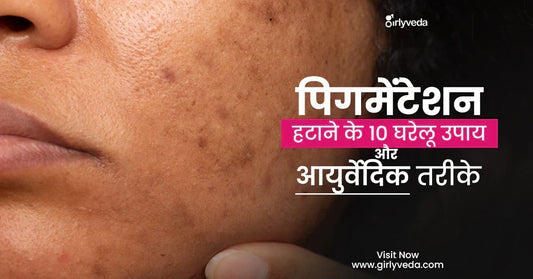 पिगमेंटेशन हटाने के 10 घरेलू उपाय और आयुर्वेदिक तरीके (Home Remedies for Pigmentation)