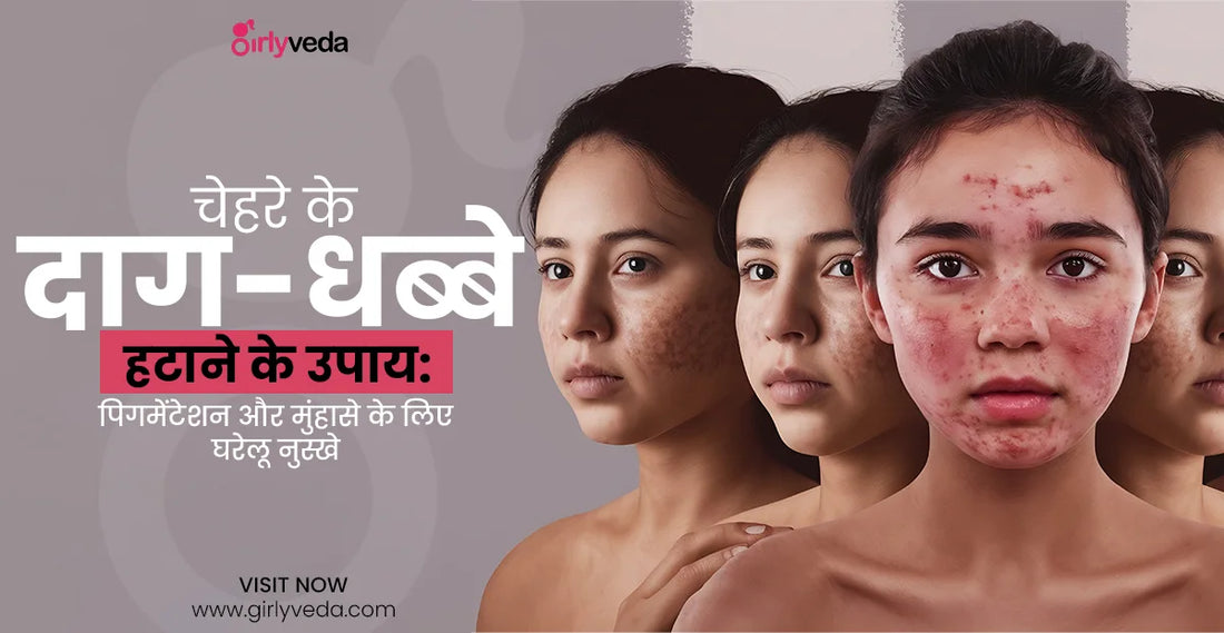 चेहरे पर काले दाग-धब्बे कैसे हटाए - Face Ke Daag Dhabbe Kaise Hataye