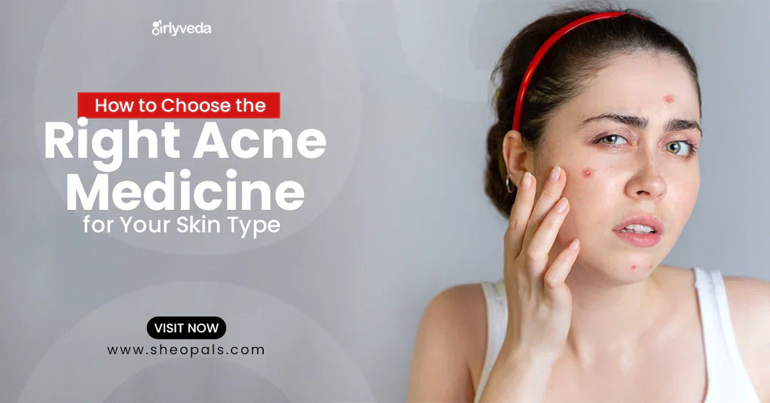 How To Choose The Right Acne Medicine For Your Skin Type