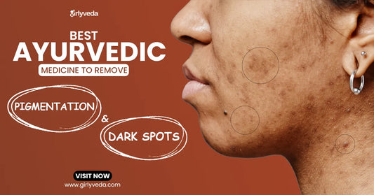 Best Ayurvedic Medicine to Remove Dark Spots and Pigmentation