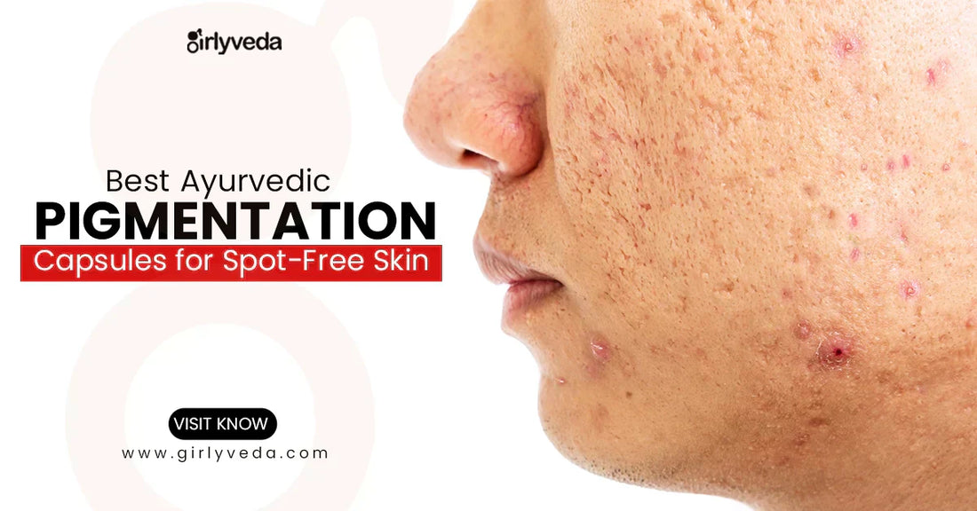 Best Ayurvedic Pigmentation Tablets for Spot-Free Skin