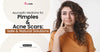 Ayurvedic Medicine For Pimples And Acne Scars: Safe & Natural Solutions