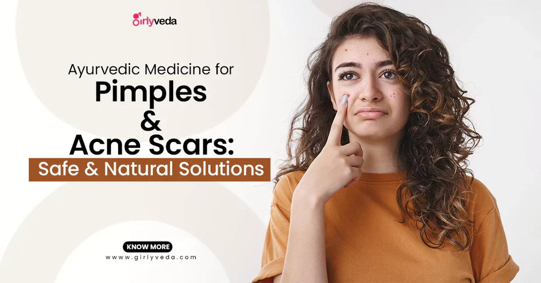 Ayurvedic Medicine For Pimples And Acne Scars: Safe & Natural Solutions