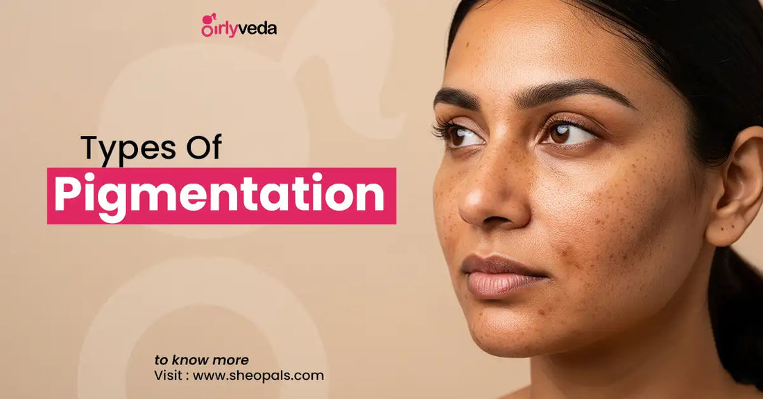 Types of Pigmentation